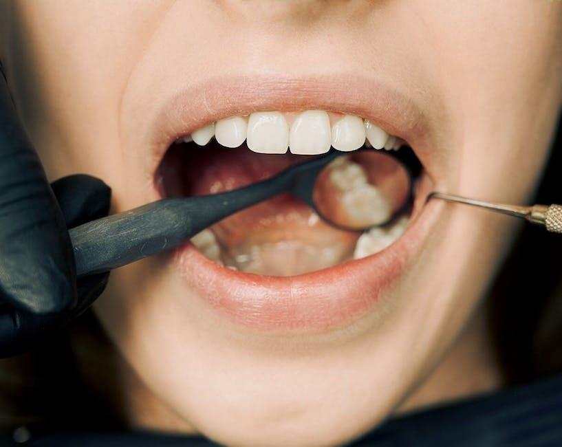 Close-up of an open mouth during a dental checkup with mirror and probe tools.
