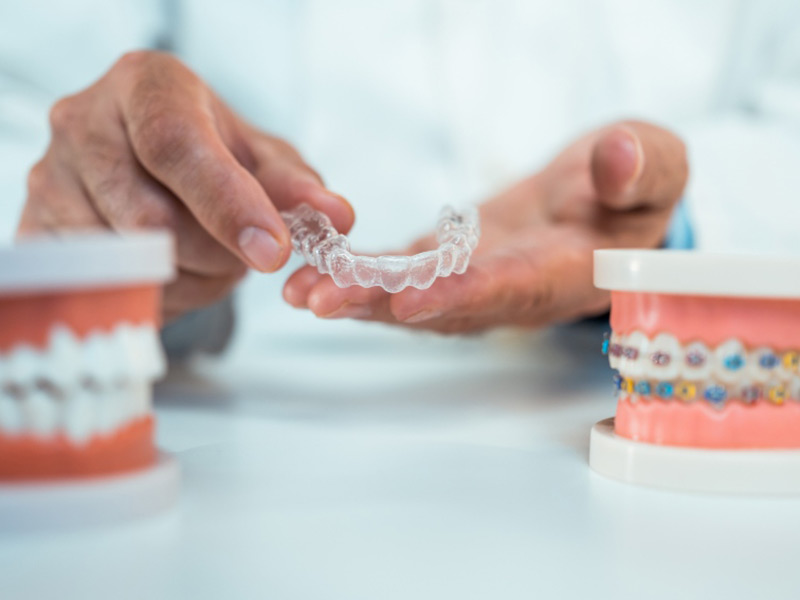 Featured image for “8 Tips to Get the Best Results From Your Invisalign”